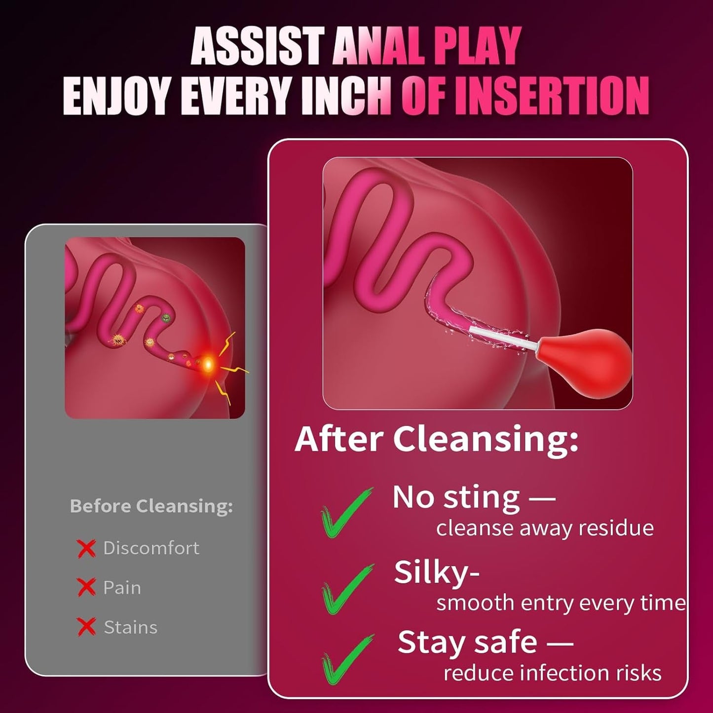ApexRise 5-Pc Anal Kit, 10 Modes, App & Remote - Vixen Adult Playroom