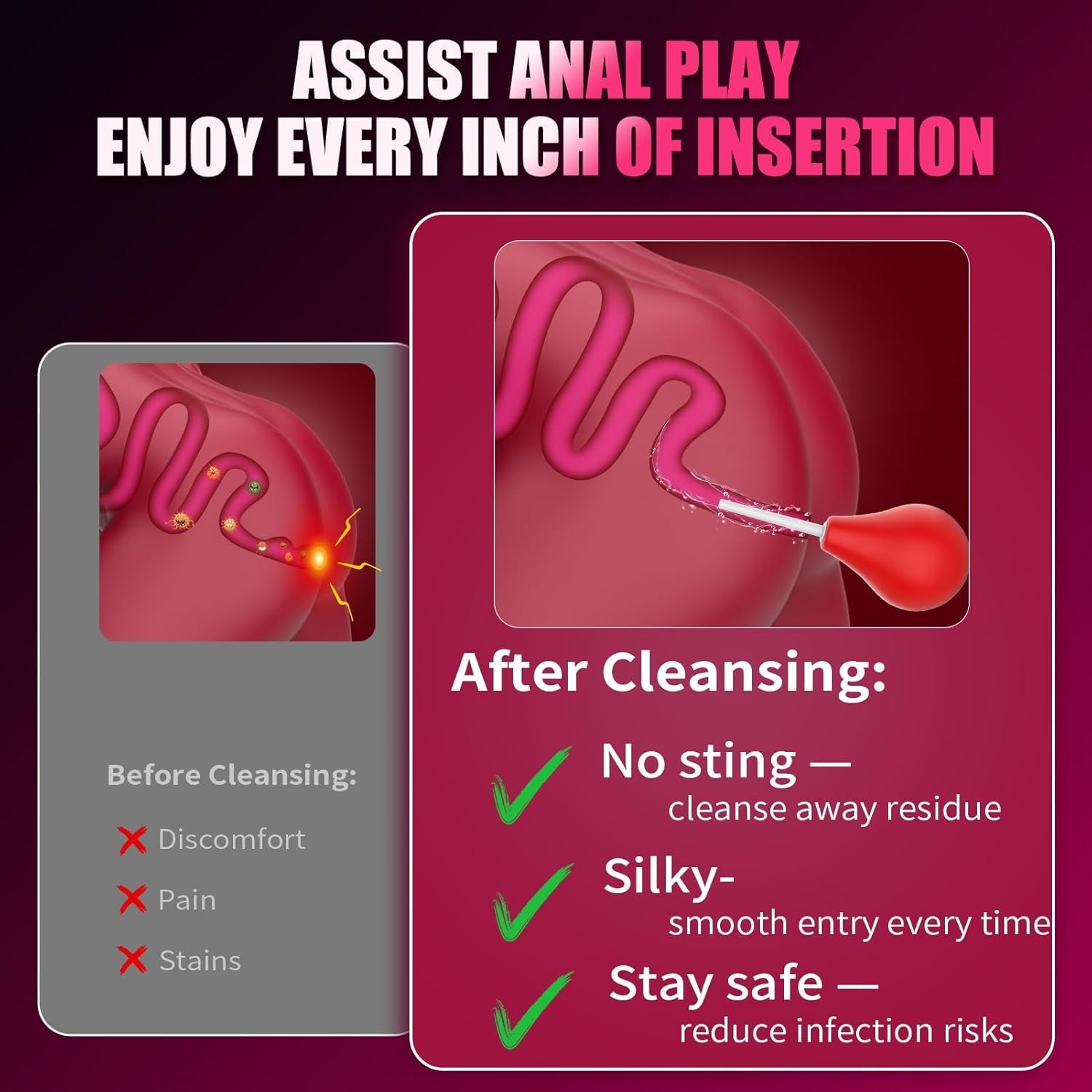 ApexRise 5-Pc Anal Kit, 10 Modes, App & Remote - Vixen Adult Playroom